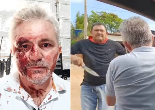 Vereador petista ataca jornalista com faca no Piauí