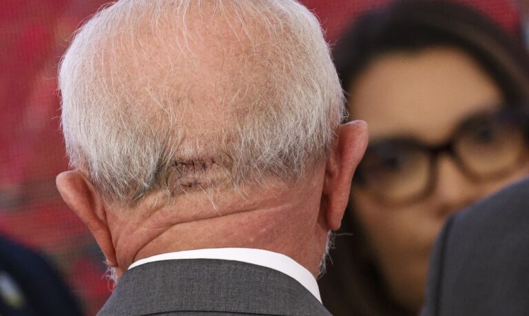Lula participa de primeiro evento após queda