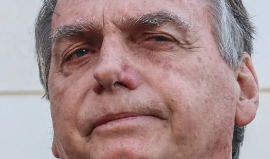 Bolsonaro teve crise de soluço na prisão e precisou de auxílio; saiba detalhes